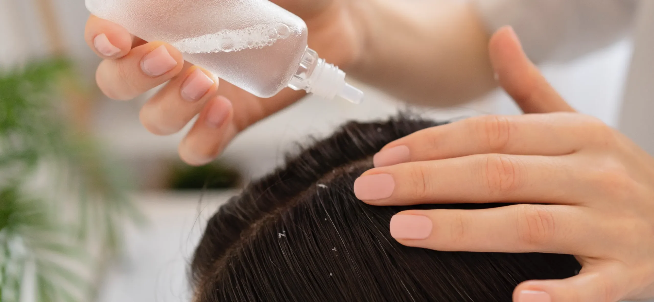 Dandruff scalp treatment guide at Singapore salon