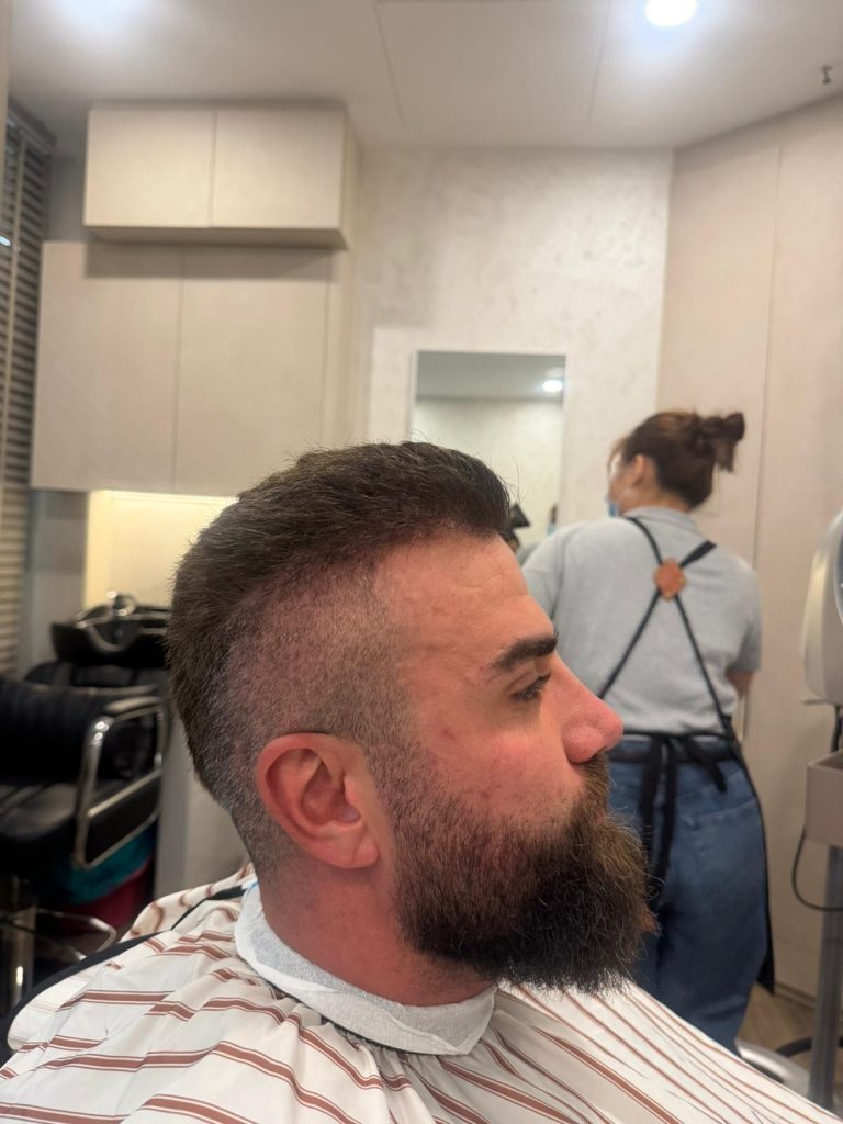 Men’s Skin Fade + Beard Sculpt – Clean, Structured Finish ✂️ before