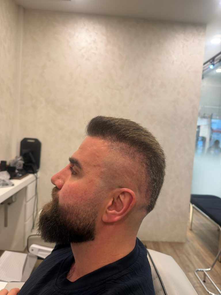 Men’s Skin Fade + Beard Sculpt – Clean, Structured Finish ✂️ after