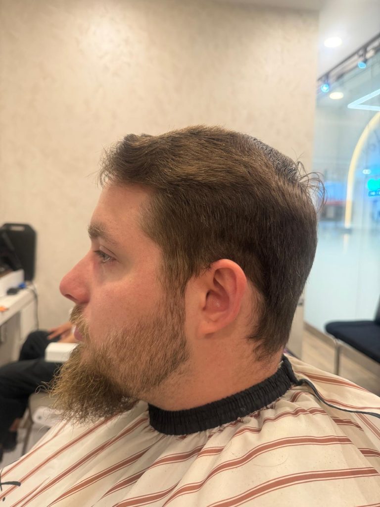 Classic Low Fade & Beard Grooming | Before & After before
