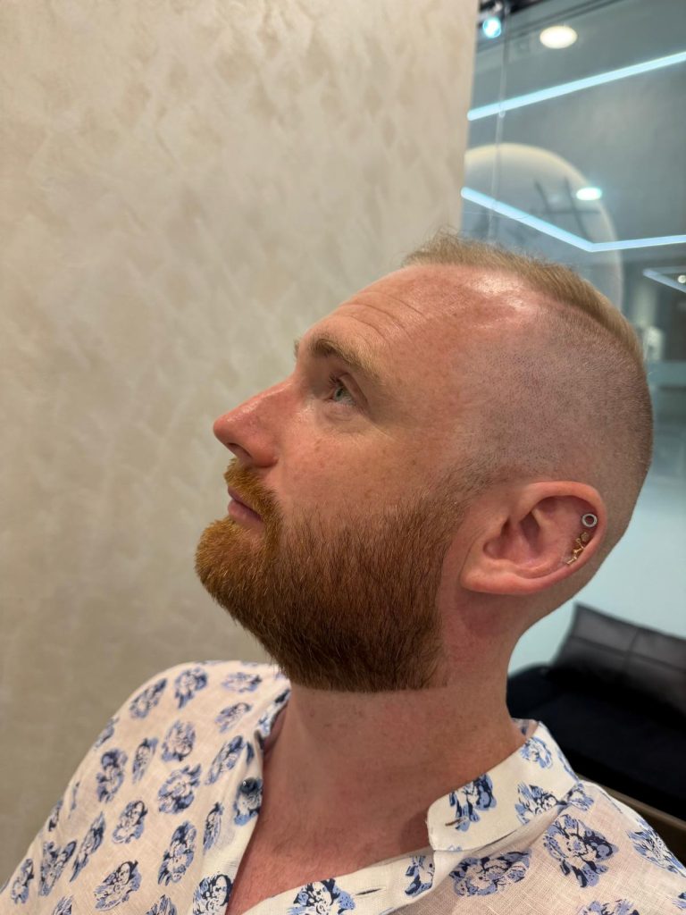 Beard Trim & Sculpt | Premium Beard Grooming in Orchard Singapore after